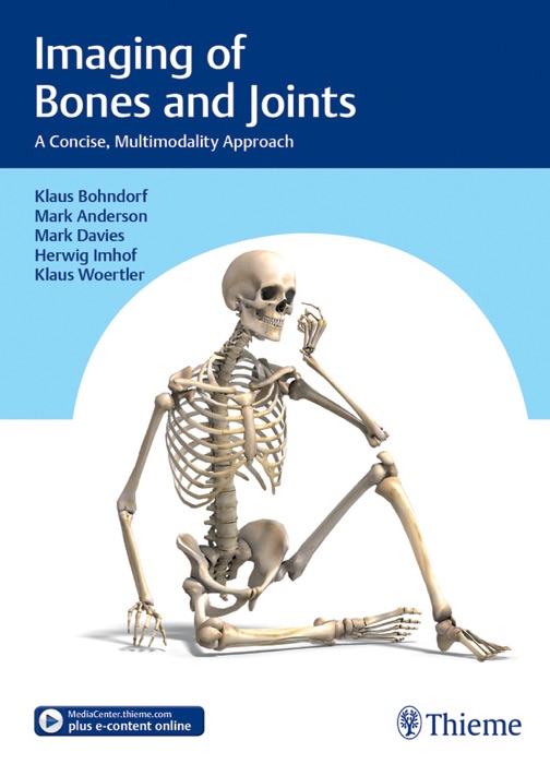 Imaging of Bones and Joints