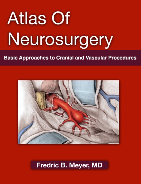 Atlas of Neurosurgery: Basic Approaches to Cranial and Vascular Procedures