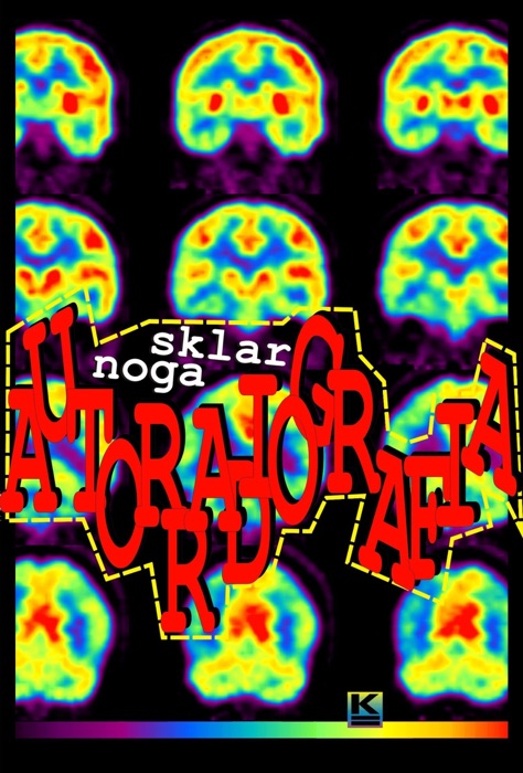 Autorradiografia