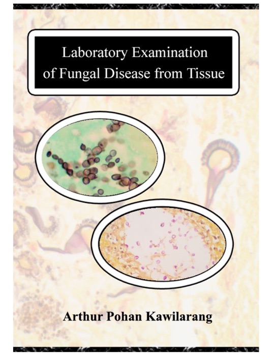 Laboratory Examination of Fungal Disease from Tissue