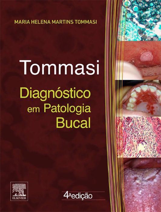 Download Diagnóstico Em Patologia Bucal By Antonio Fernando Tommasi And Maria Helena Tommasi