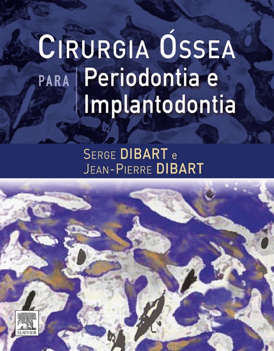 Cirurgia Óssea para Periodontia e Implantodontia