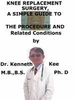 Kenneth Kee - Knee Replacement Surgery, A Simple Guide To The Procedure And Related Conditions artwork
