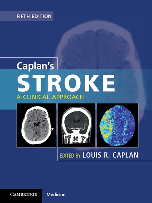 Caplan's Stroke: Fifth Edition