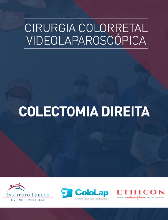 Videoatlas: Colectomia Direita