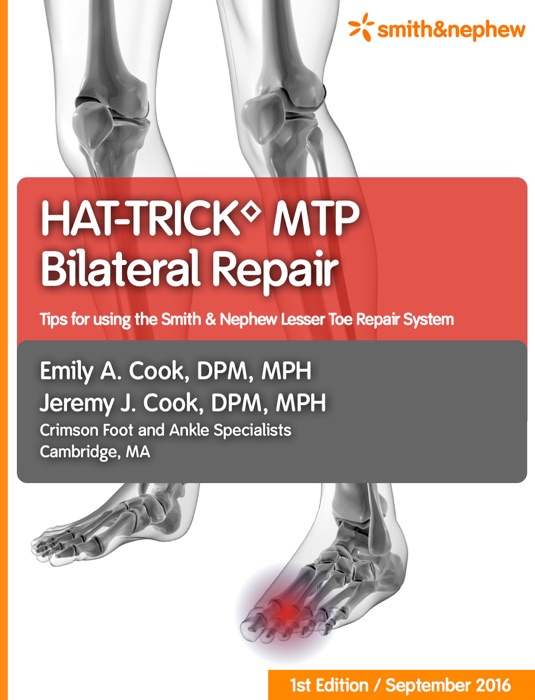 HAT-TRICK MTP Bilateral Repair