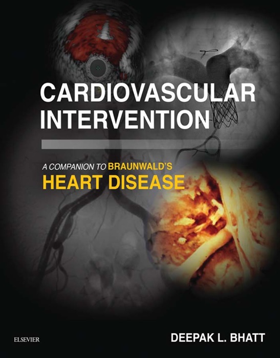 Cardiovascular Intervention