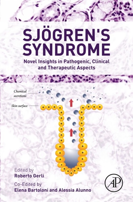 Sjogren's Syndrome