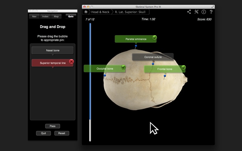 Skeletal System Pro III screenshot1