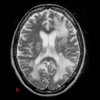 neurology figures