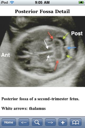 Guide To High-Risk Pregnancy(圖5)-速報App