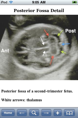 Guide To High-Risk Pregnancy screenshot-4