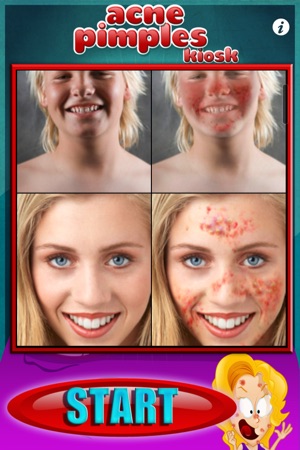 Acne Pimples Kiosk © HD Lite(圖2)-速報App