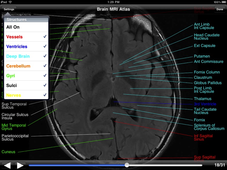 Brain MRI Atlas