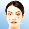 ACNE Care Treatment