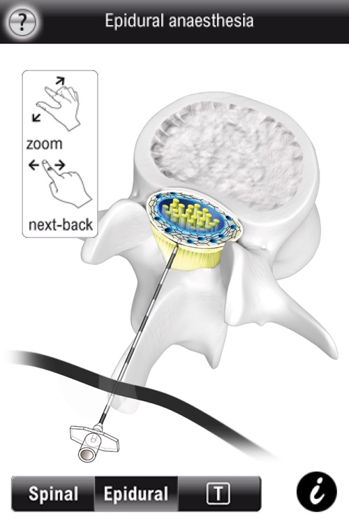 Spinal Vademecum screenshot-3