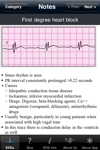 ECG Pocket Reference