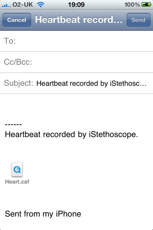 iStethoscope Free screenshot-4