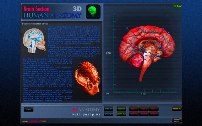 Brain Section 3D(圖3)-速報App