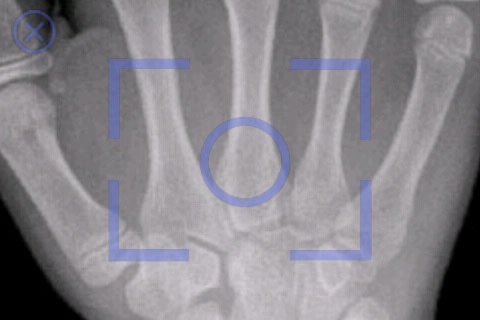 iRay Mobile X-Ray screenshot-3