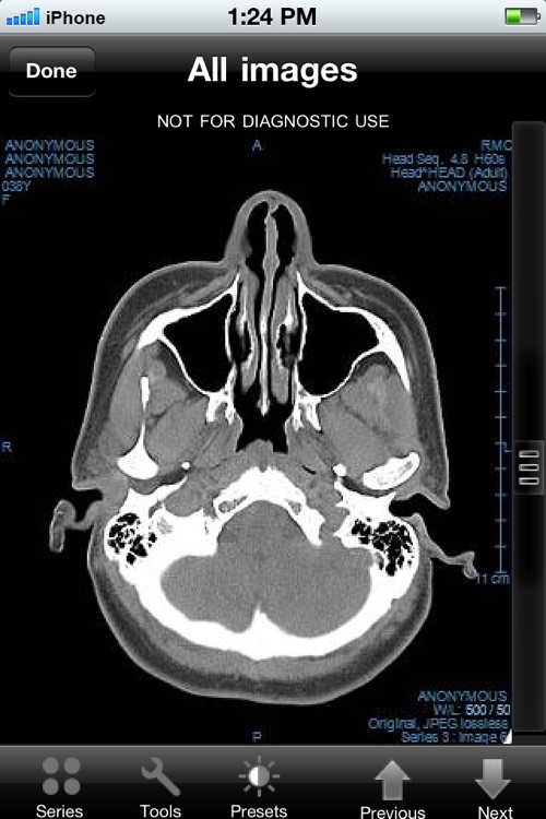 vRad Results