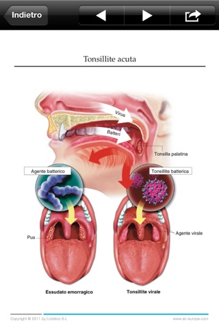 Miniatlas Ear, Nose & Throat screenshot 4