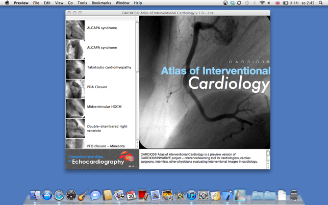 CARDIO3® Atlas of Interventional Cardiology – Lite(圖1)-速報App