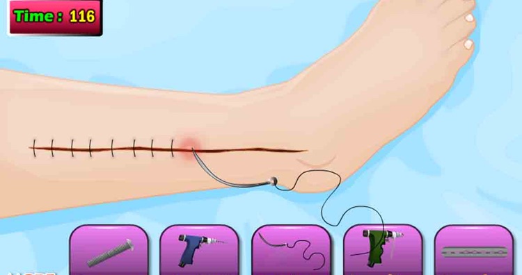 Tom Leg Surgery Doctor Game