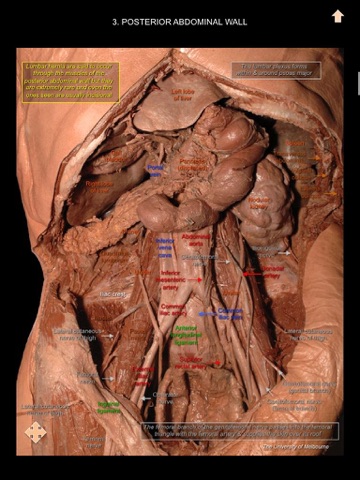 Exploring Essential Anatomy screenshot 4