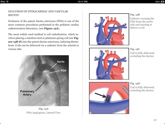 illustrated field guide to congenital heart disease and repair download