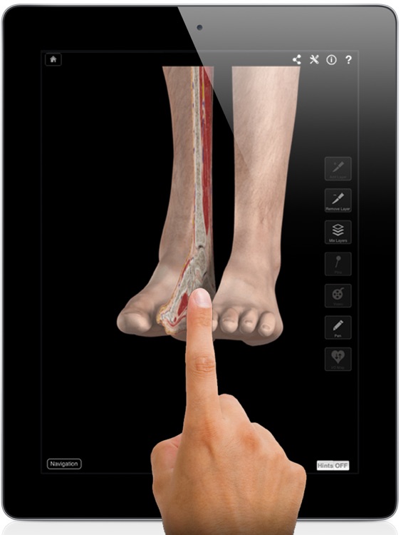 Ankle & Foot Pro III for iPad screenshot-0