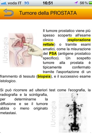 iUrologia - fdm screenshot 3