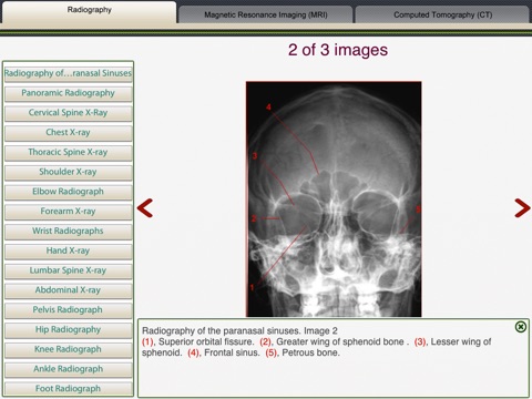 MRI-Xray Human Body screenshot 2