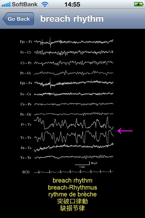 electroencephalography multilingual