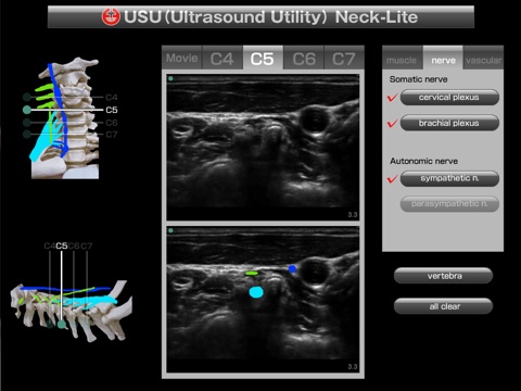USU neck-lite screenshot 4