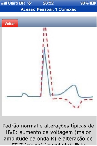 ECG Pratico screenshot 2