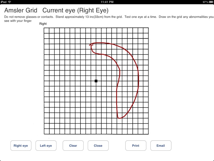 eyePatientsFree screenshot-4