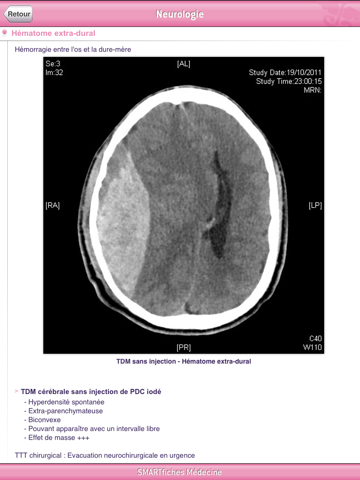 SMARTfiches Neurologie HD Free screenshot 2