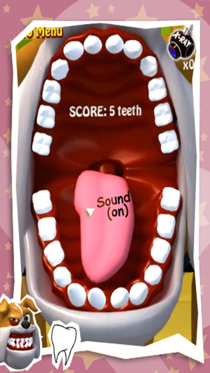 Spark Tooth Out screenshot-3