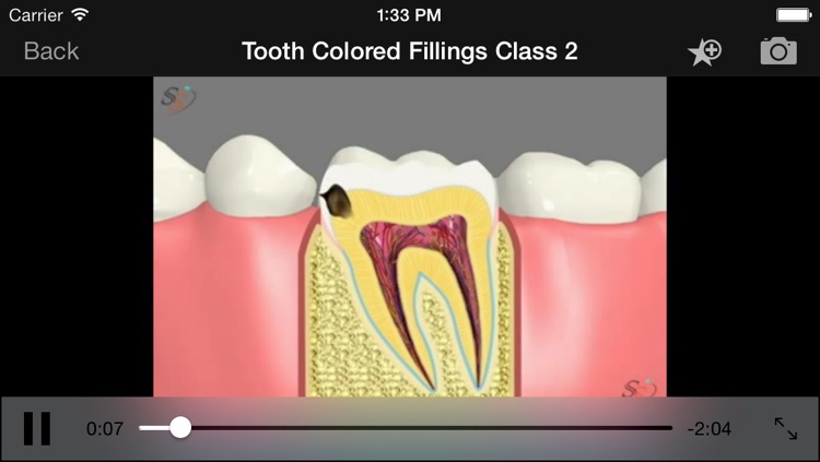 American Dental Software - 3D Dental Patient Education