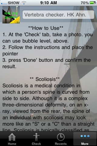 Vertebra(spine) checker (scoliosis) lite screenshot 4