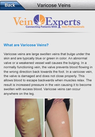 Vein Experts screenshot 4