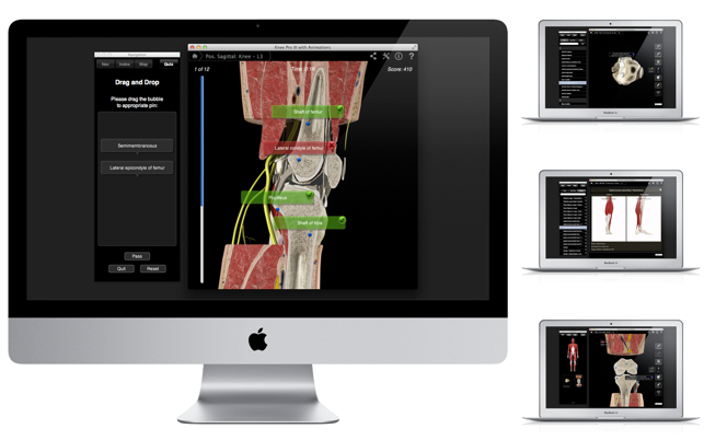 Knee Pro III with Animations(圖5)-速報App