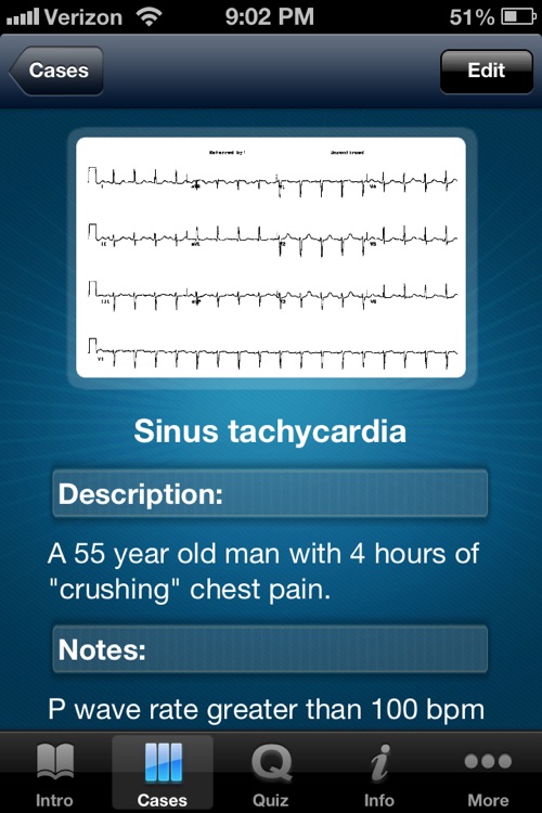 ECG - An Electrocardiogram Review for Healthcare Professionals