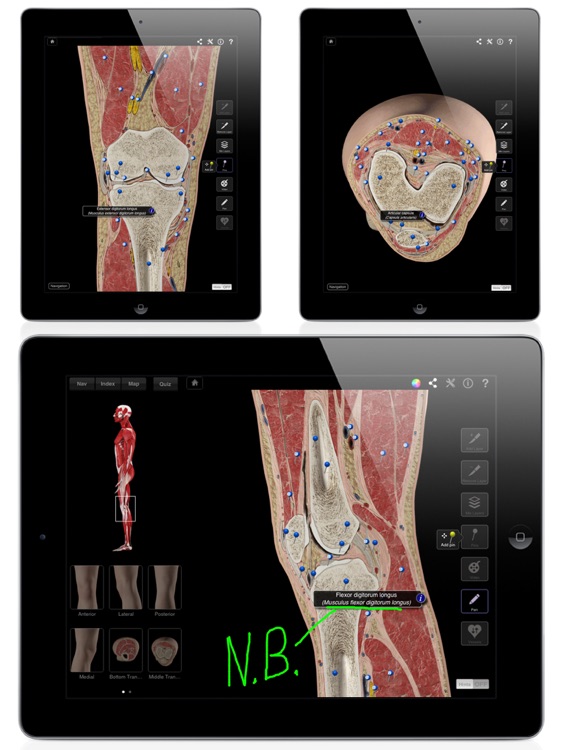Knee Pro III for iPad