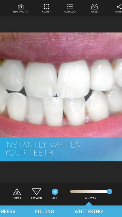 Virtual Dentist