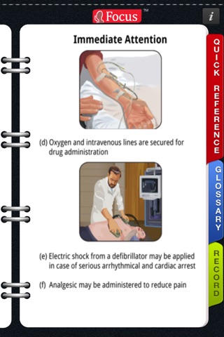 Animated Quick Reference - Cardiac Events screenshot 4