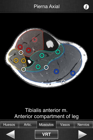 Monster Anatomy HD - Lower Limb screenshot 4