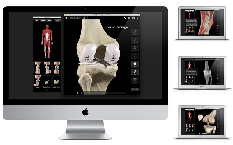 Knee Pro III with Animations küçük resim 2