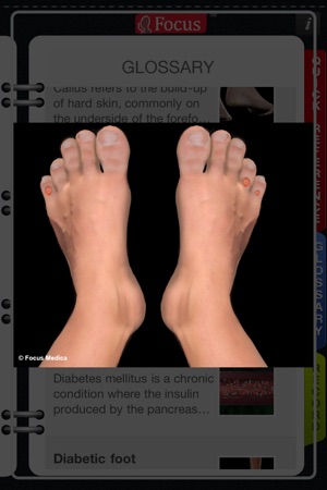 Animated Quick Reference Guide -  DiabeticFoot(圖3)-速報App